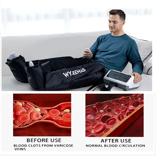 Blood Circulation Pump For Legs industry insight