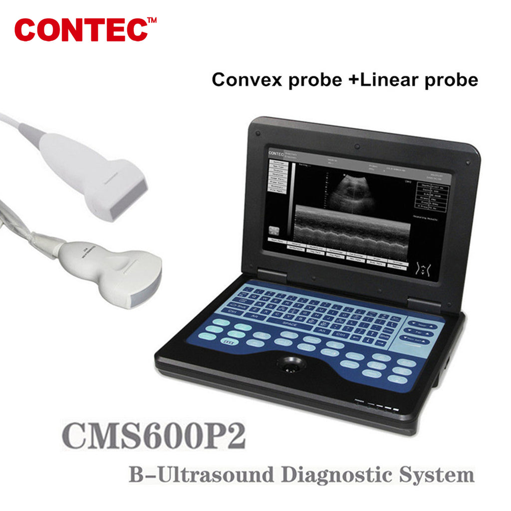 Diagnostic Ultrasound Systems: from portable to cart