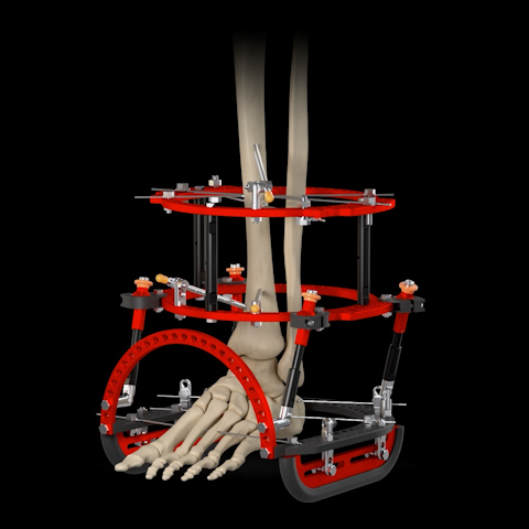 Enovis™ Foot & Ankle