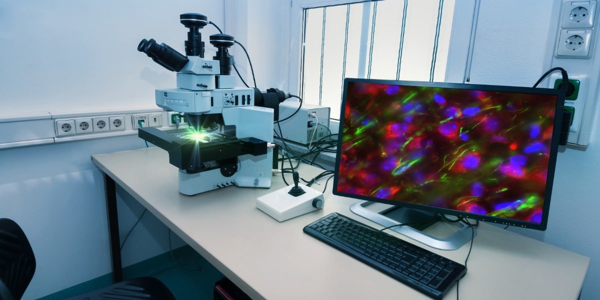 Fluorescence Microscope industry insight