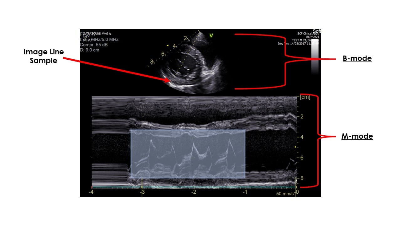 M Mode Doppler Ultrasound industry insight