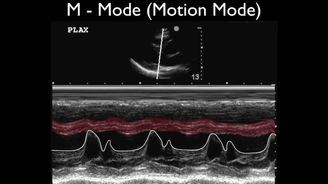 M Mode Doppler Ultrasound industry insight