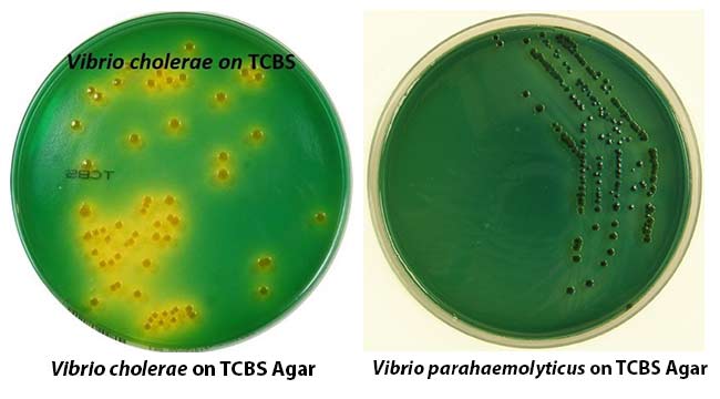 TCBS Agar