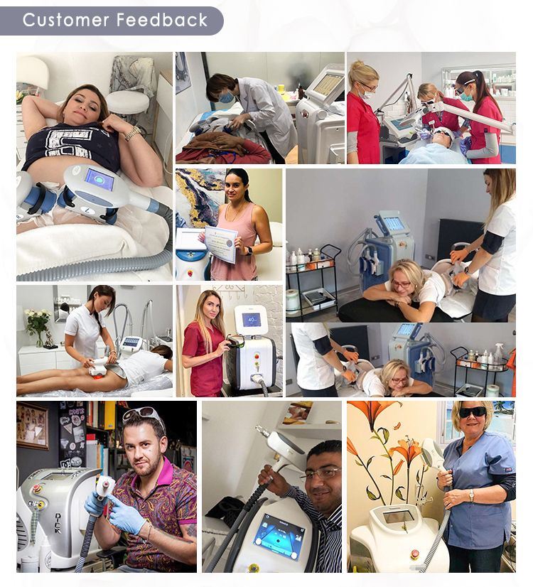 Ultrapulse Co2 Laser industry insight