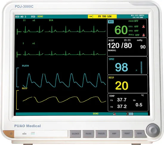 Vital Sign Monitor industry insight