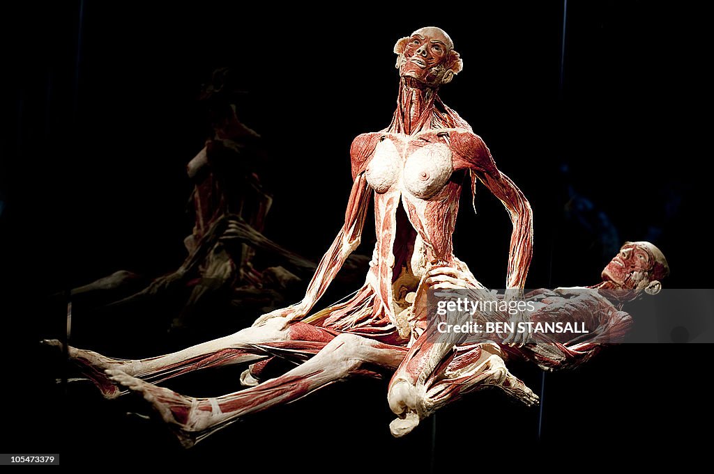 von Hagens Plastination