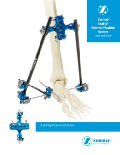 XtraFix® External Fixation System